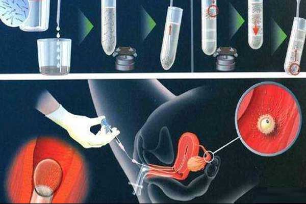 胚胎移植过程图
