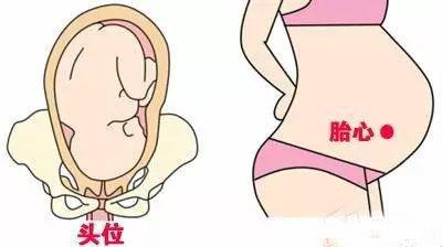 胎心位置与胎位图解