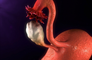 石家庄干细胞治疗卵巢早衰，患者顺利分娩健康宝宝